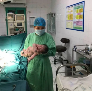 Bé gái hạ sinh thành công 