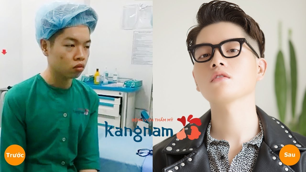 Đức Phúc trước và sau khi phẫu thuật thẩm mĩ